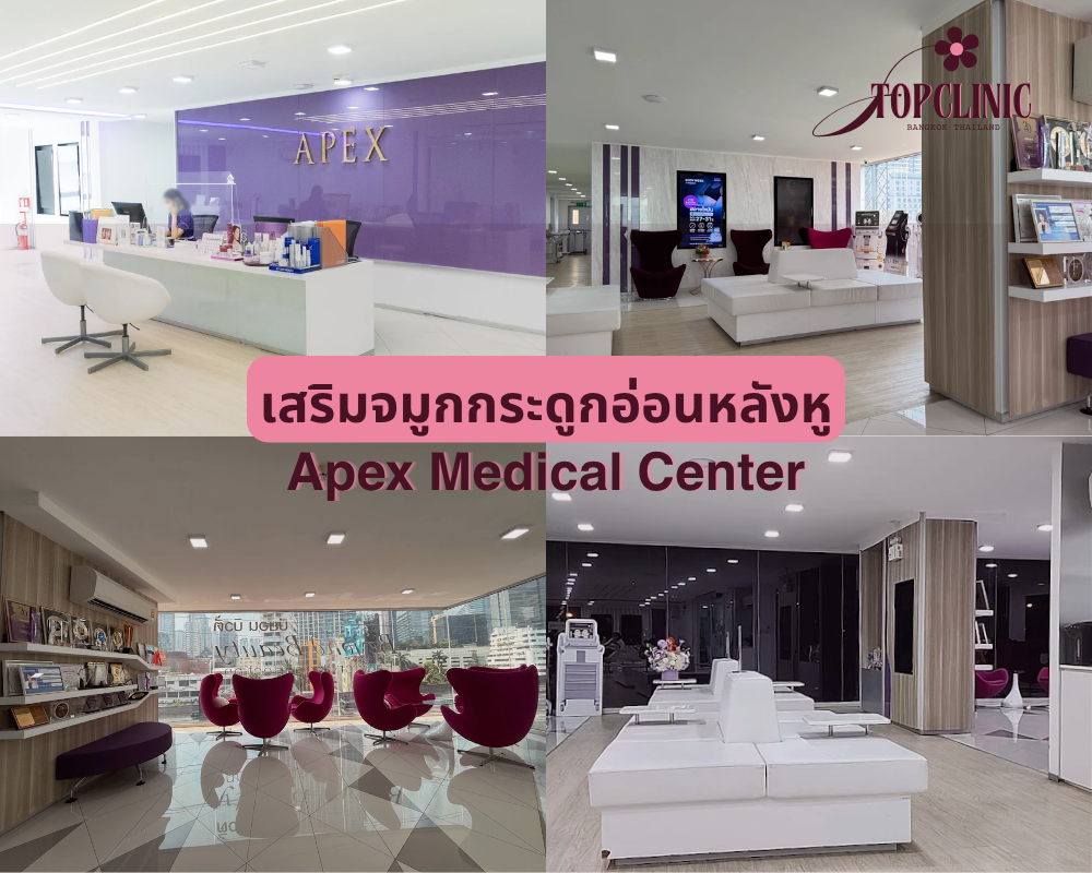 คลินิกเสริมจมูกกระดูกอ่อนหลังหู Apex Medical Center