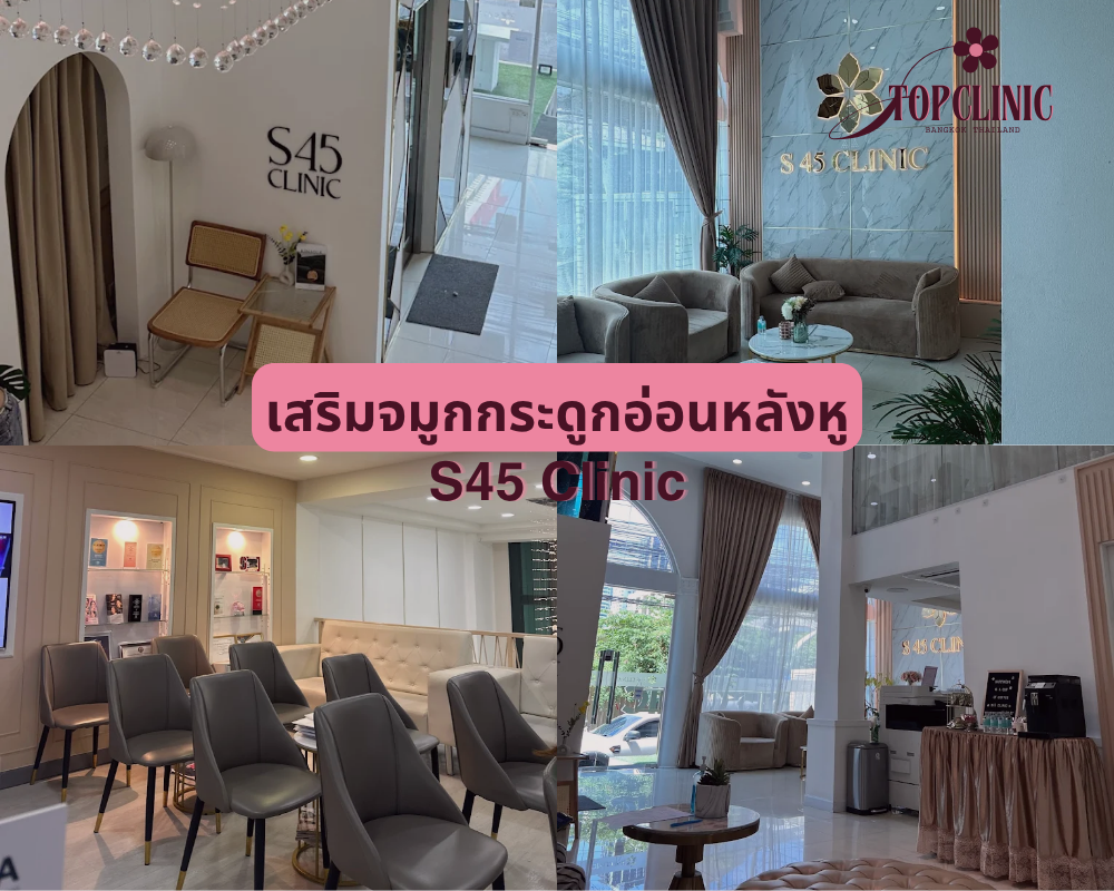 คลินิกเสริมจมูกกระดูกอ่อนหลังหู S45 Clinic