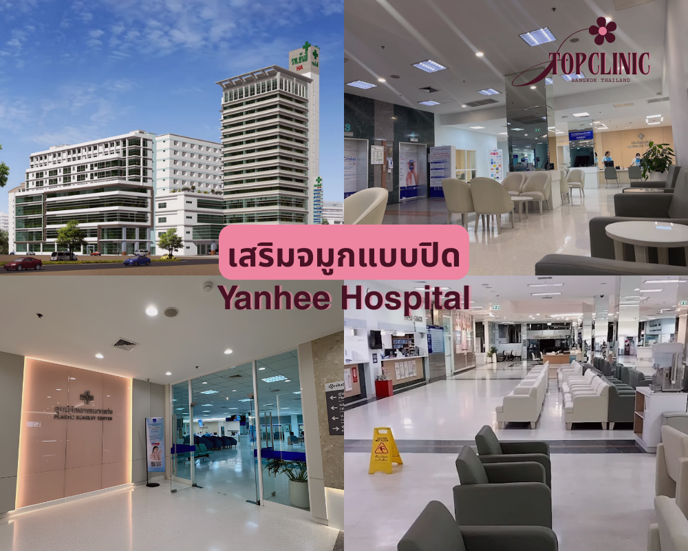 คลินิกเสริมจมูกแบบปิด Yanhee