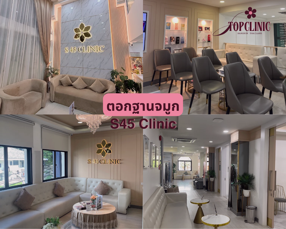 ตอกฐานจมูก S45 Clinic
