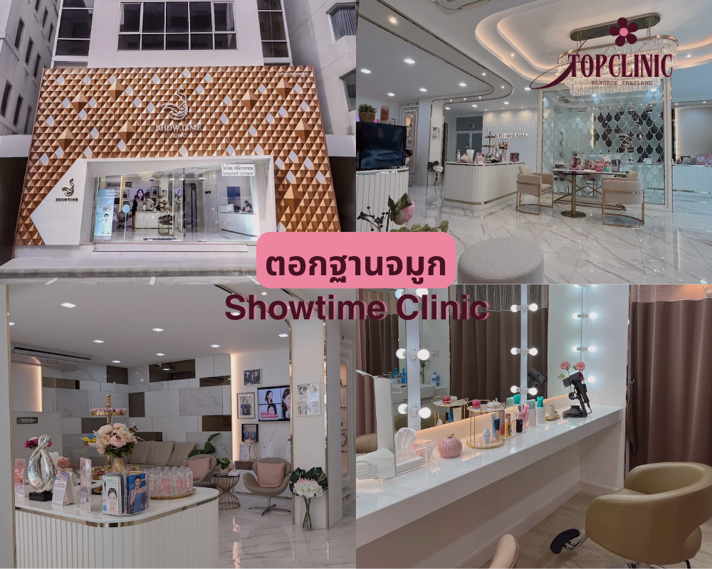 ตอกฐานจมูก Showtime Clinic